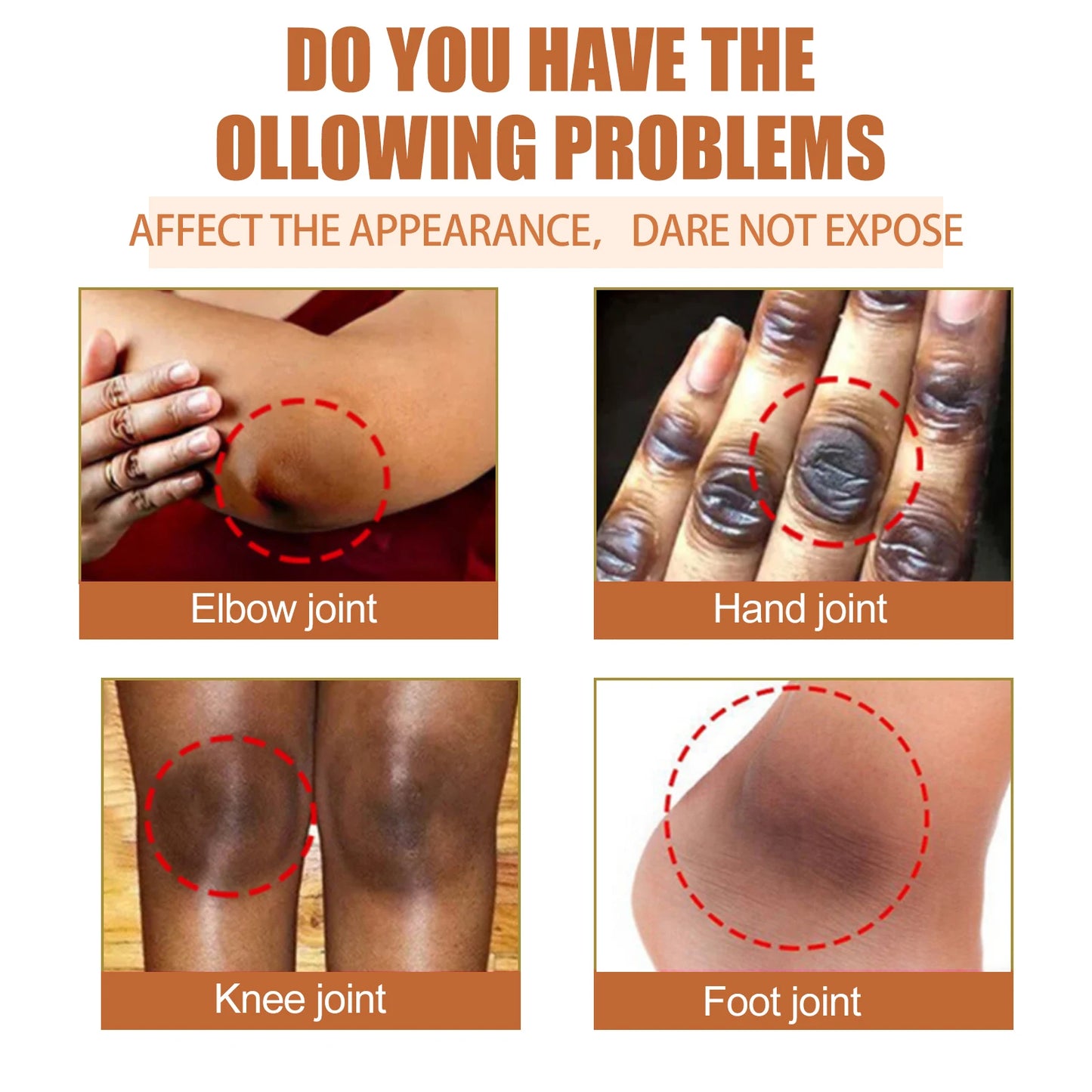 Eelhoe Papaya Skin Essence Oil For Brightening And Elasticity