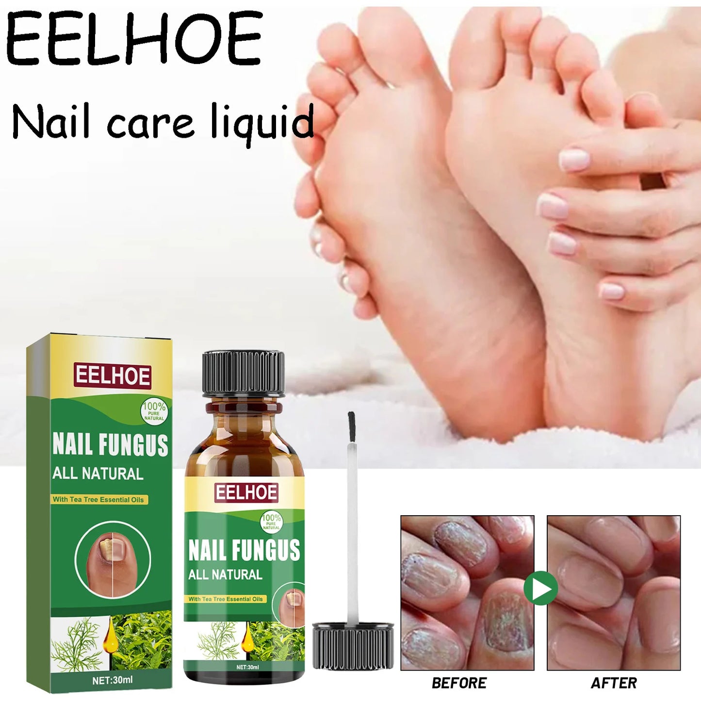 Eelhoe Tea Tree Nail Repair Liquid Nourishing Cuticle Oil