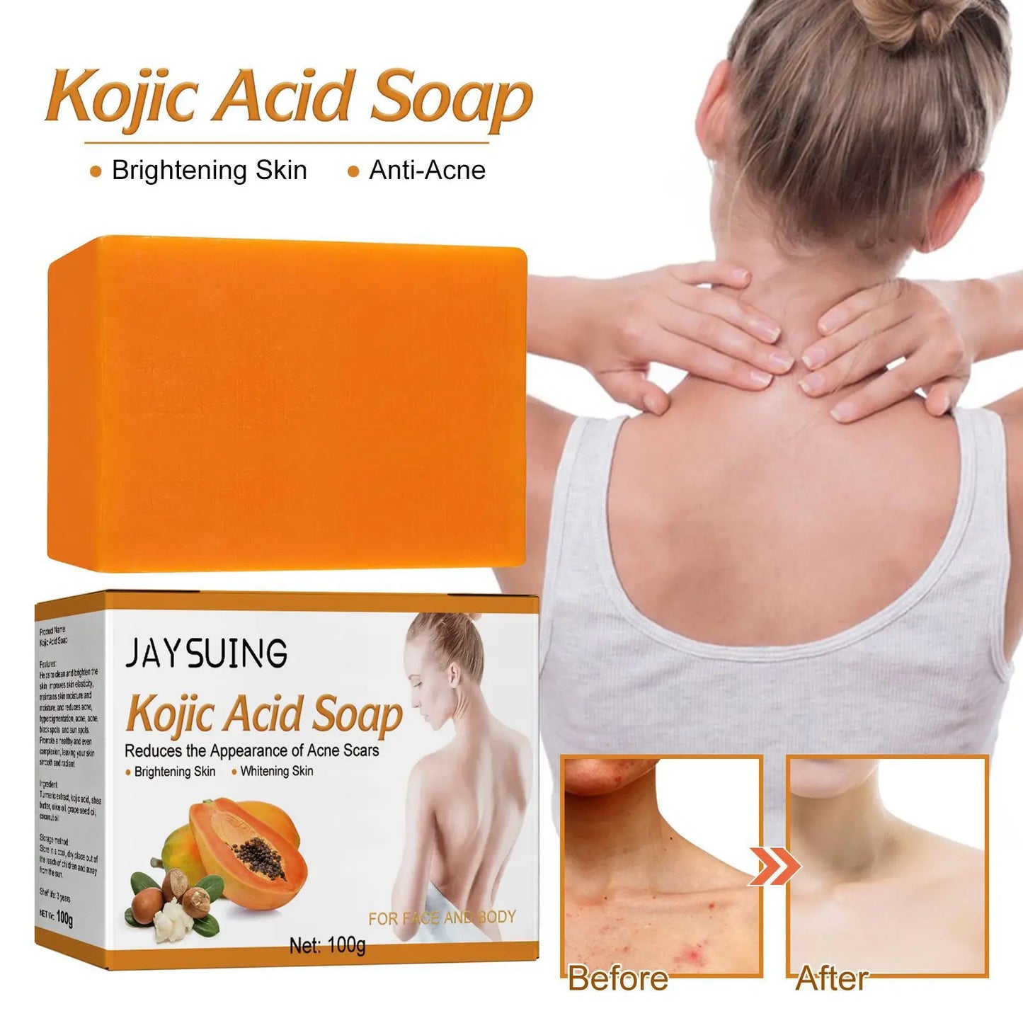 OuhoeHign-concerned Kojic Acid Skin Lightening Soap For Dark Spot Removal