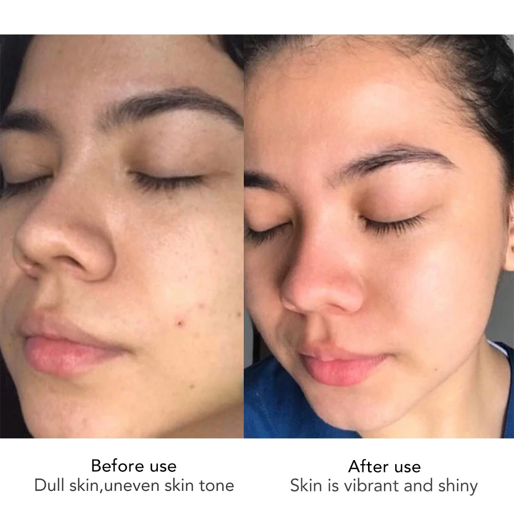 AILKE Hyaluronic Acid Face Cream Whitening Moisturizing Anti Aging Korean