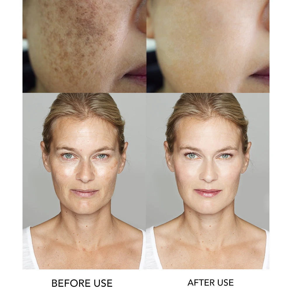 AILKE Vitamin C Face Serum For Hyperpigmentation And Hydration
