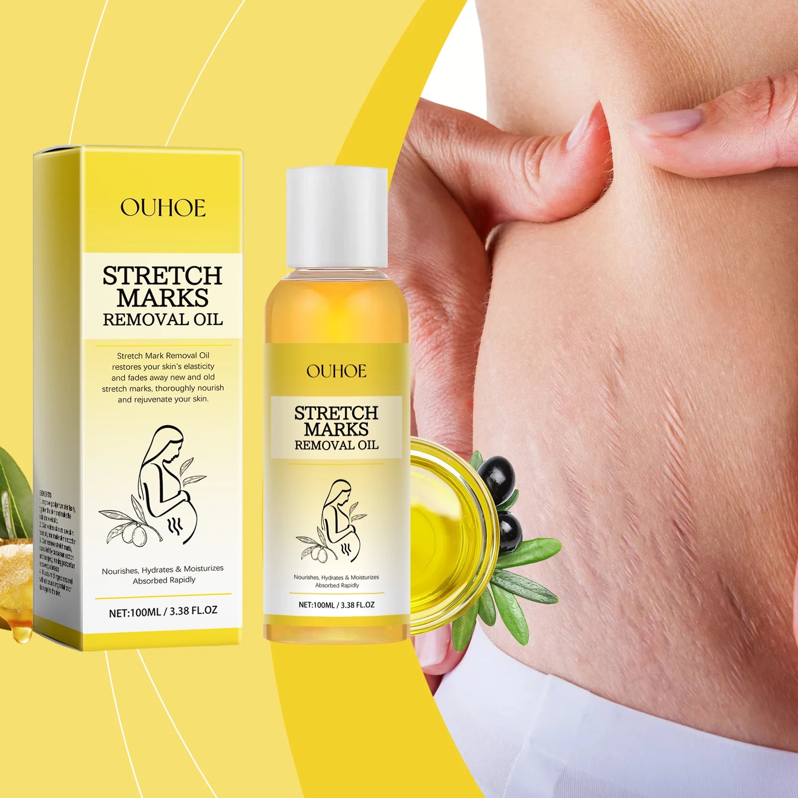 maternity stretch mark oil cream