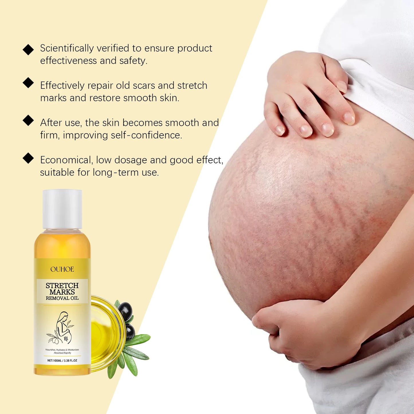 maternity stretch mark oil cream