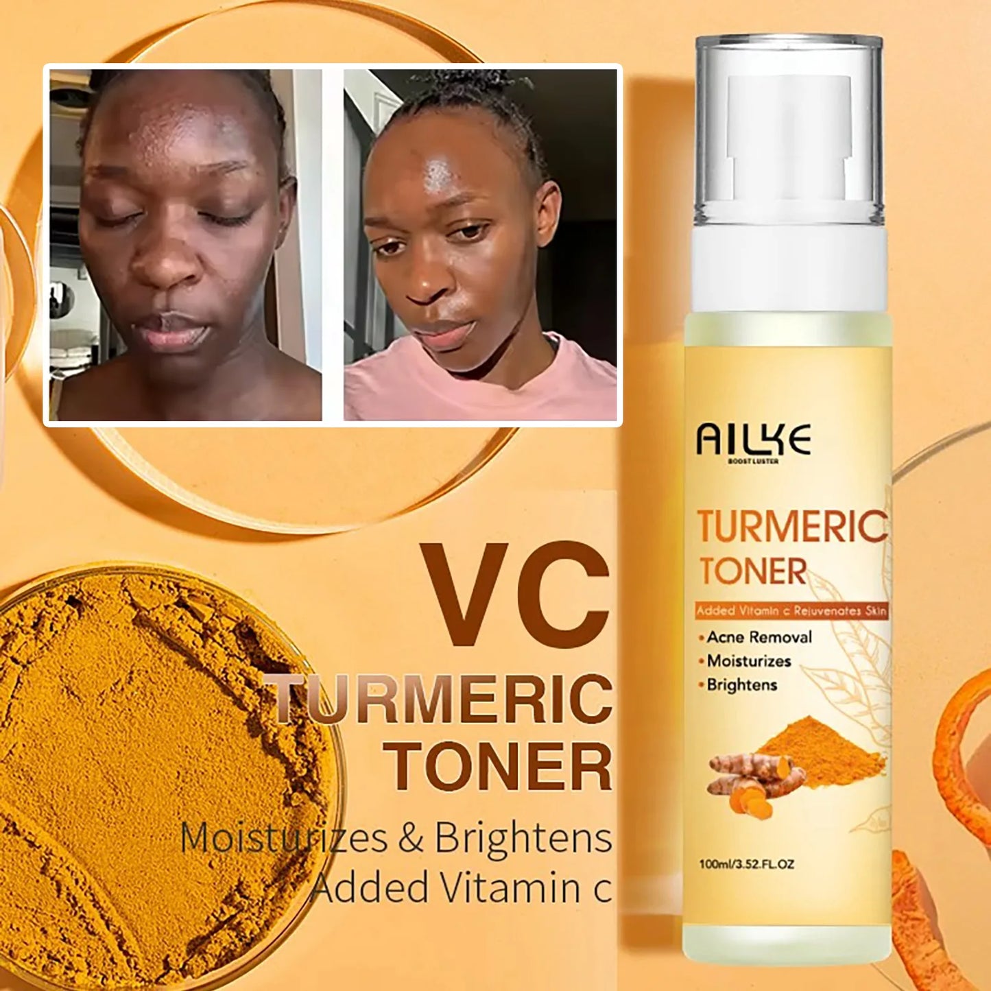 AILKE Organic Turmeric Skin Care Set for Acne and Tone