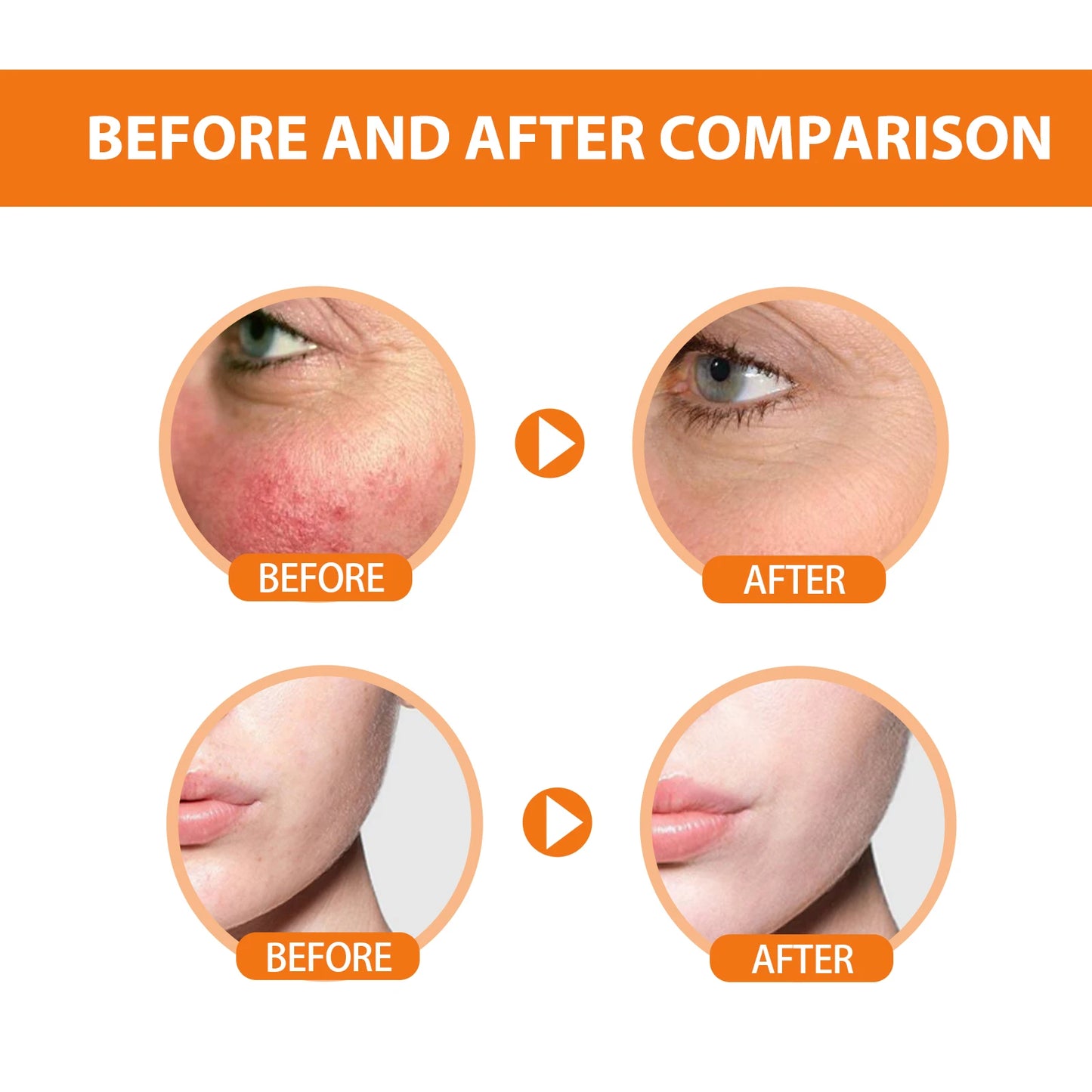 Ouhoe Sunscreen SPF50 Protective Cream Waterproof Moisturizing Face Body Blocker