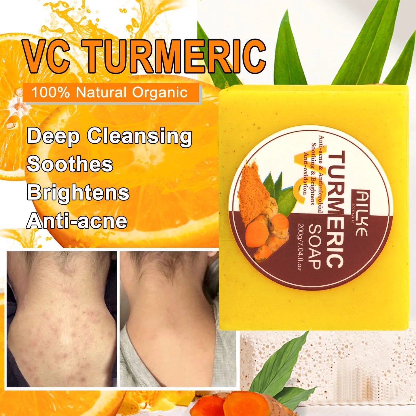 AILKE Turmeric Soap Bar Brightening Acne And Skin Tone