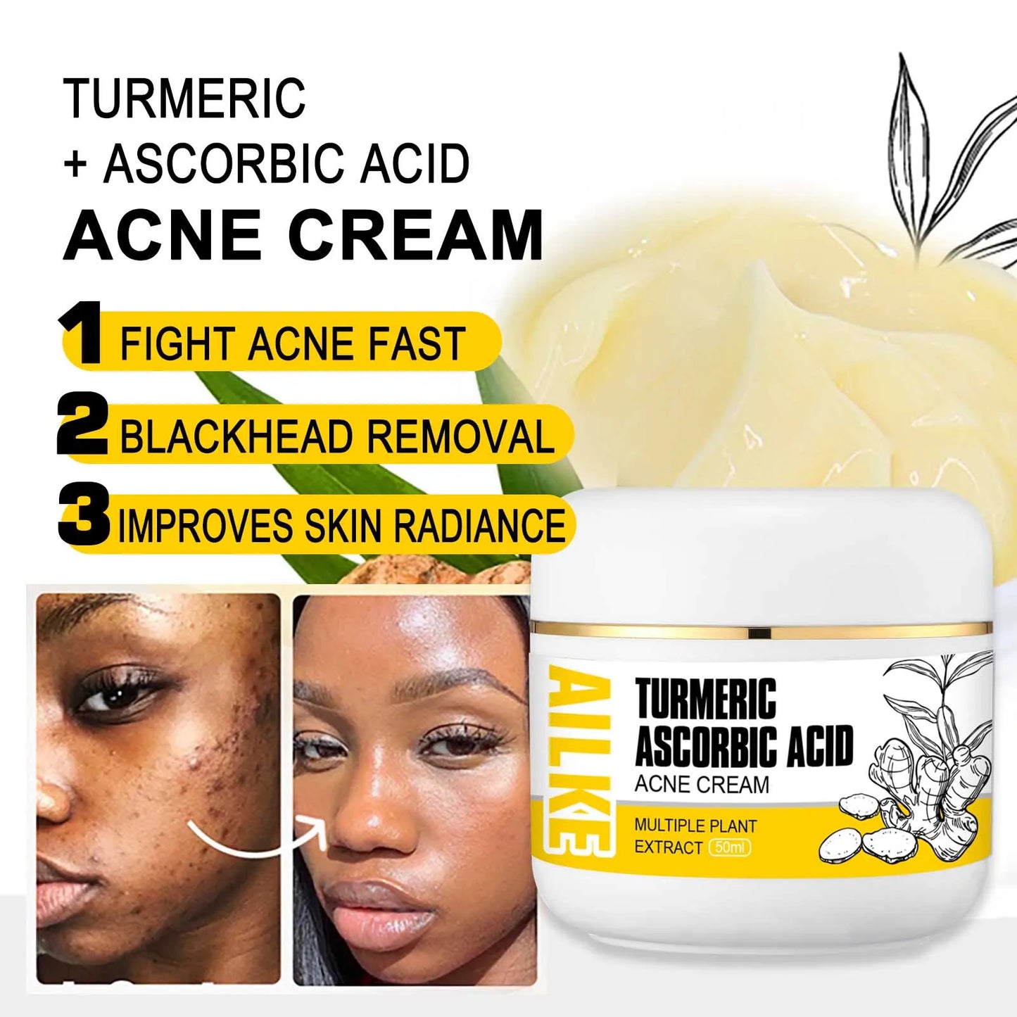 AILKE Organic Turmeric Skin Care Set for Acne and Tone