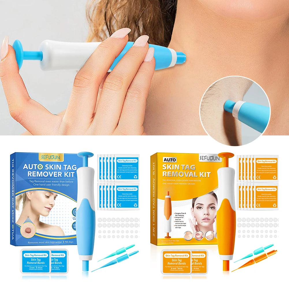 Rubber Rings Mole Removal Kit For Skin Wart Health Care