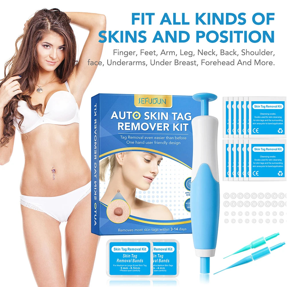 Rubber Rings Mole Removal Kit For Skin Wart Health Care