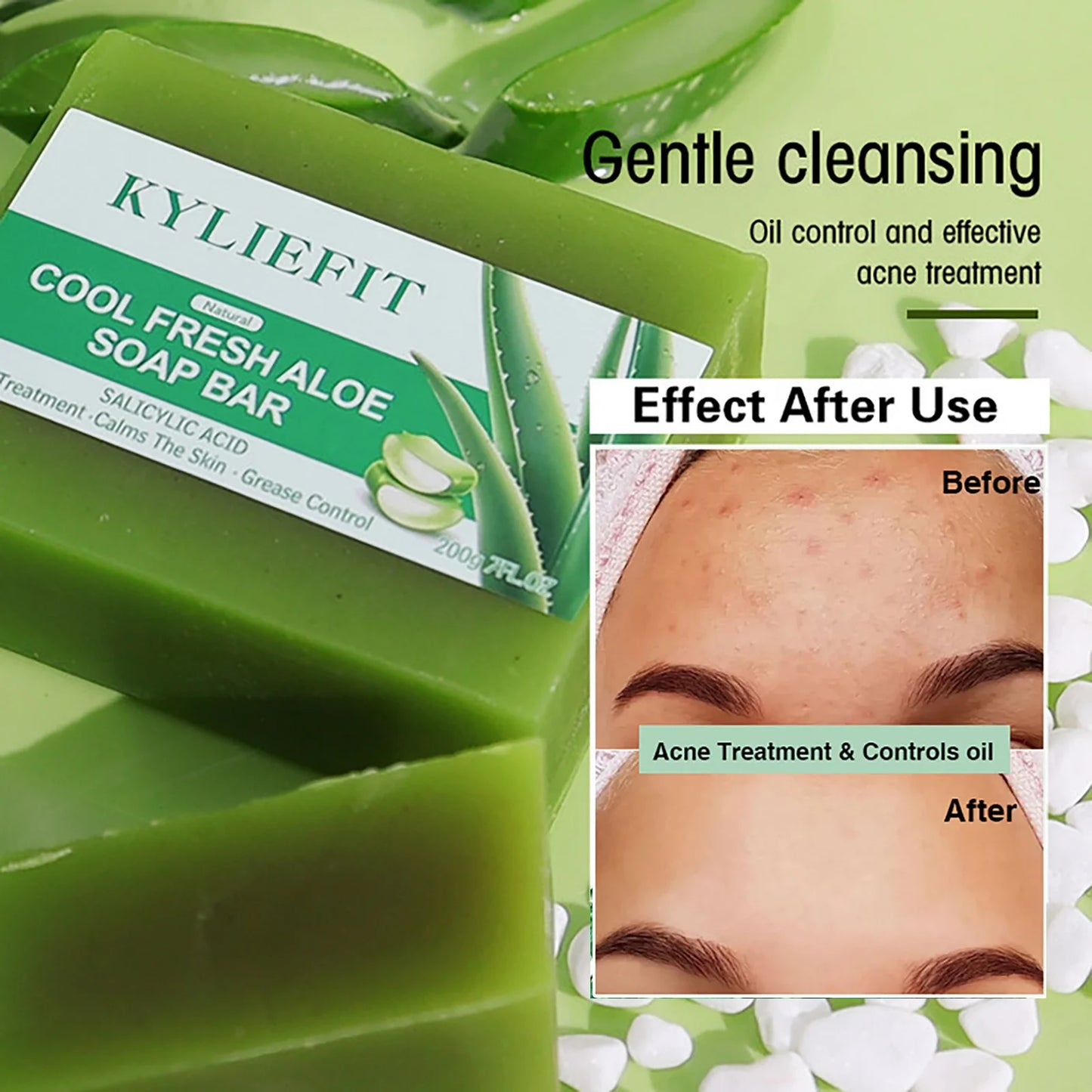 AILKE Aloe Vera Whitening Soap Acne Remover For Radiant Skin