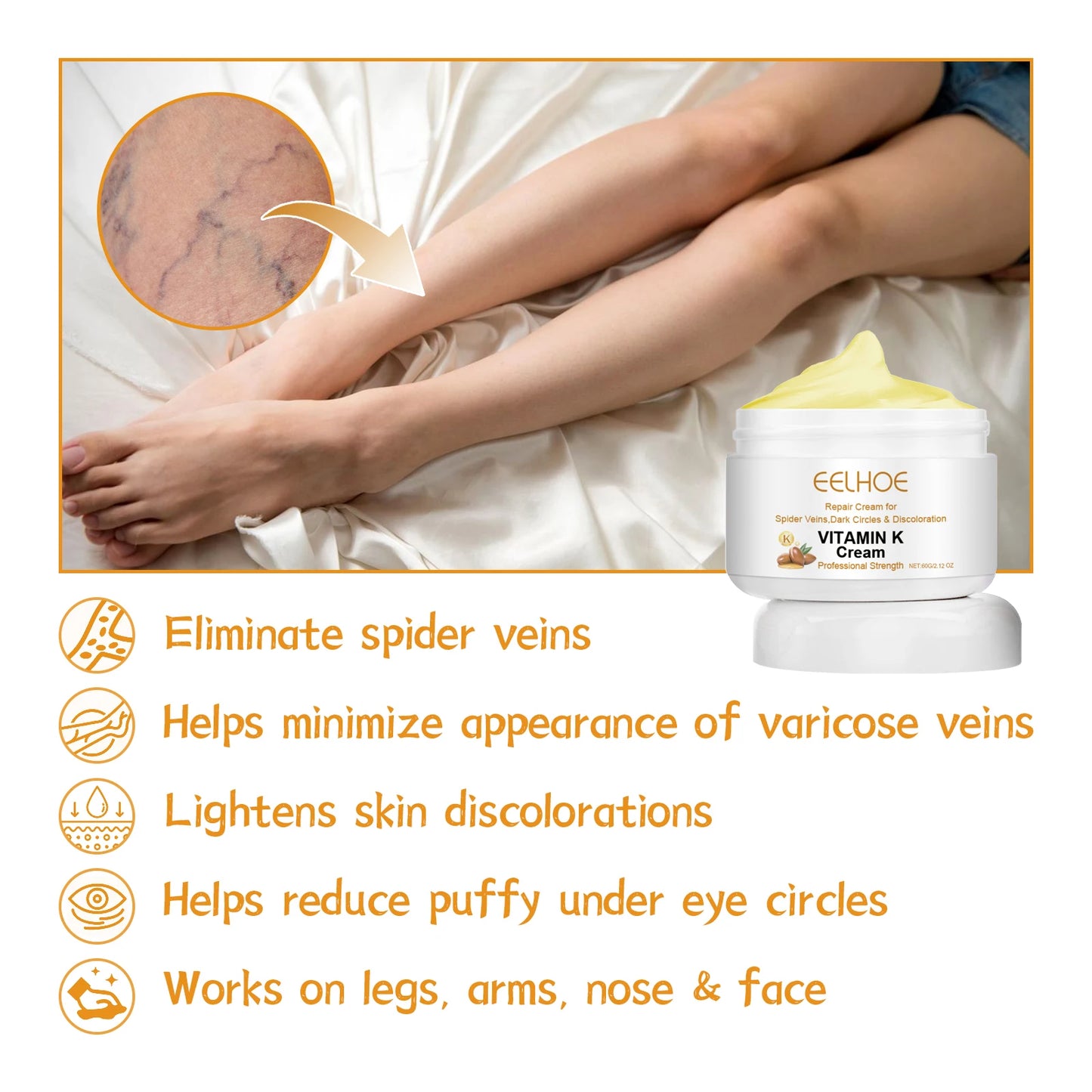 Eelhoe Vitamin K Cream for Varicose Veins and Leg Swelling