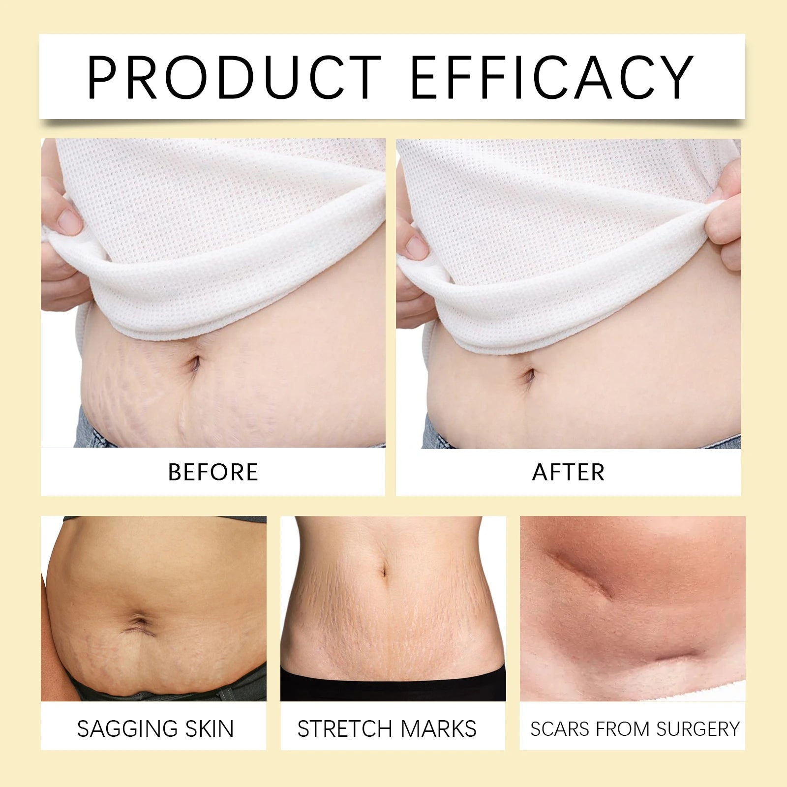 maternity stretch mark oil cream