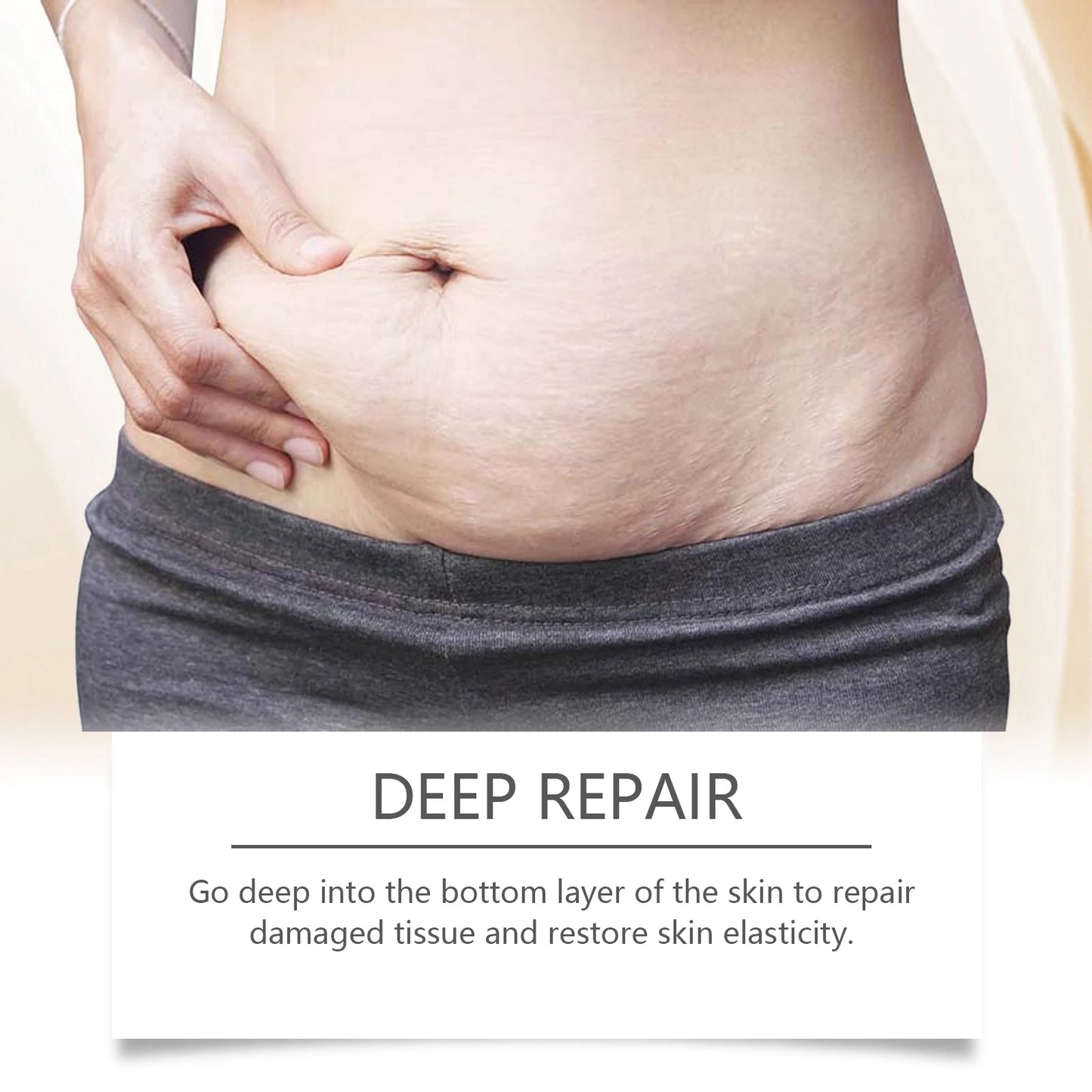 maternity stretch mark oil cream