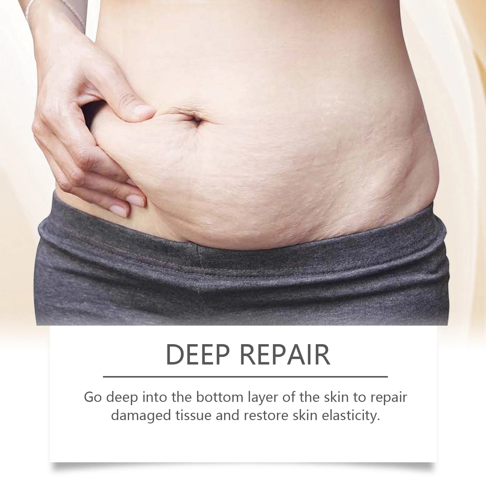 maternity stretch mark oil cream