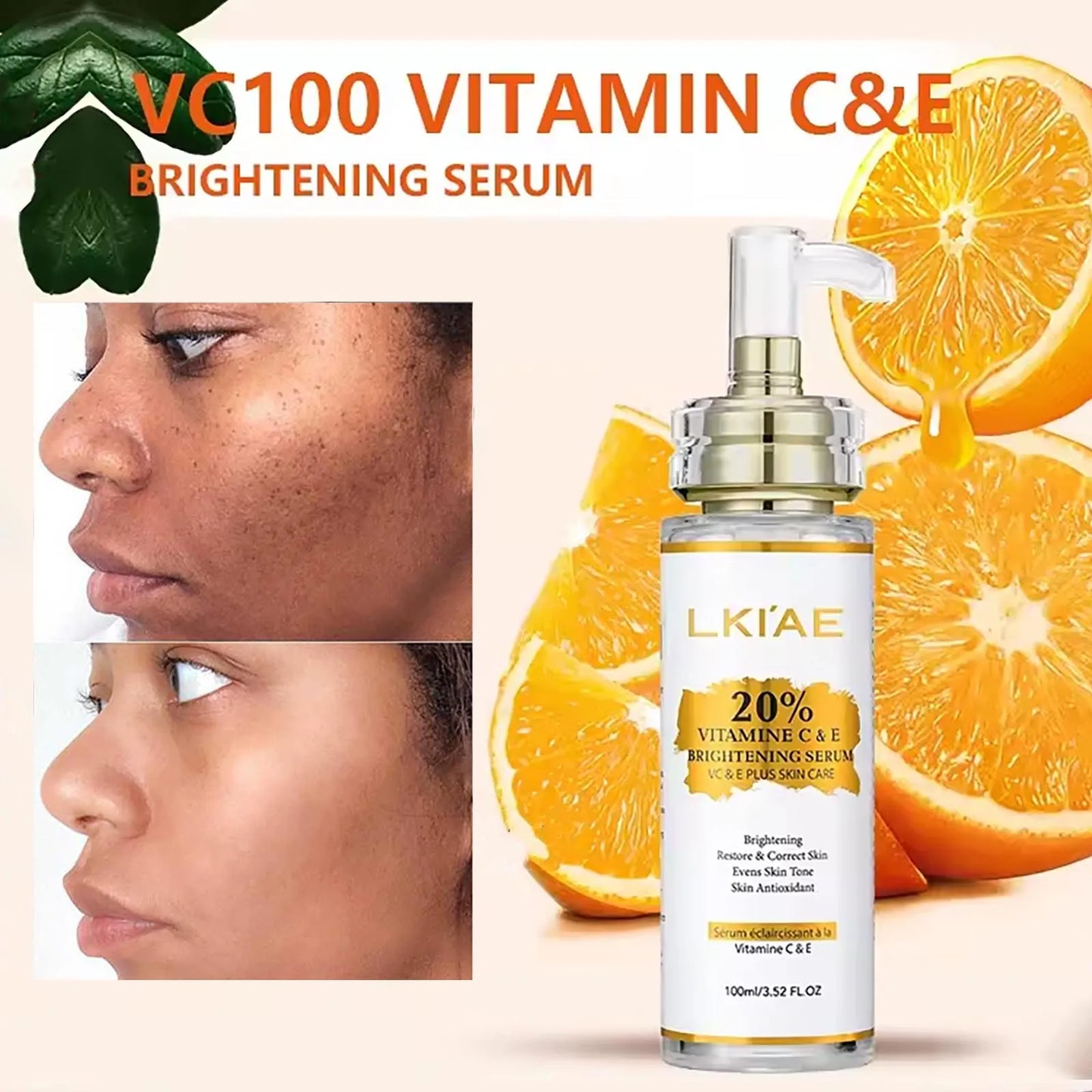 AILKE Brightening Body Cream Vitamin C Hyaluronic Acid Even Tone