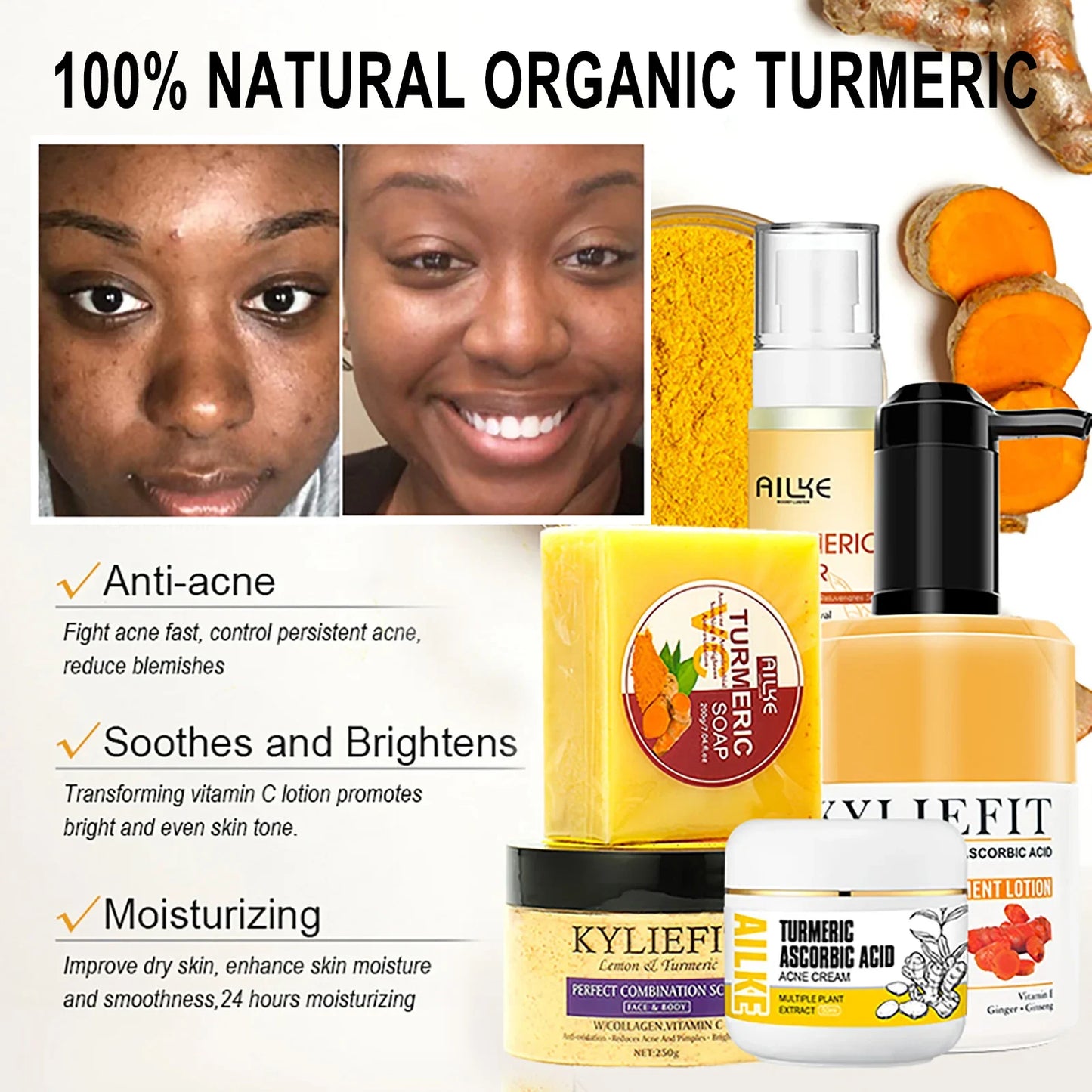 AILKE Organic Turmeric Skin Care Set for Acne and Tone