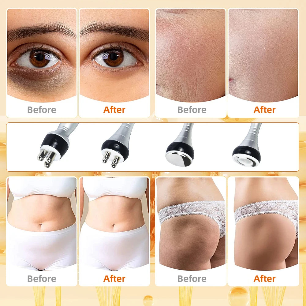 ultrasonic cavitation body slimming machine